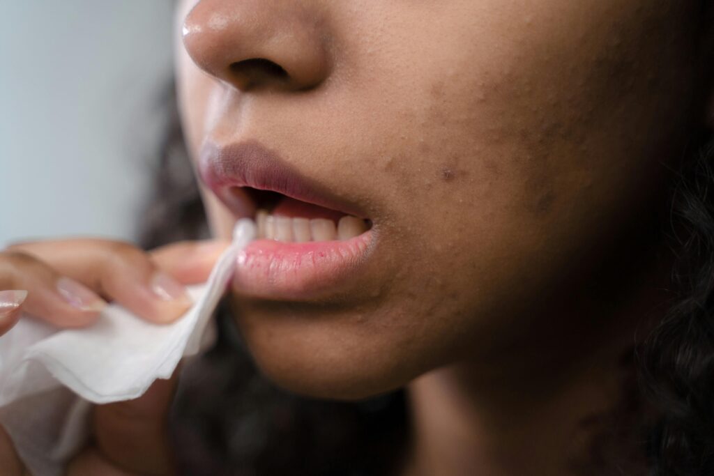 Girl exfoliating her lips to remove pigmentation, using a natural scrub for effective lip pigmentation removal