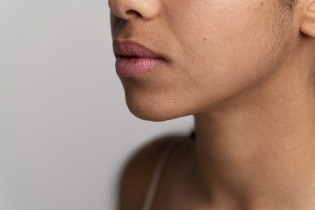 A close-up of skin with visible hyperpigmentation around the mouth, showing dark patches caused by melanin overproduction.