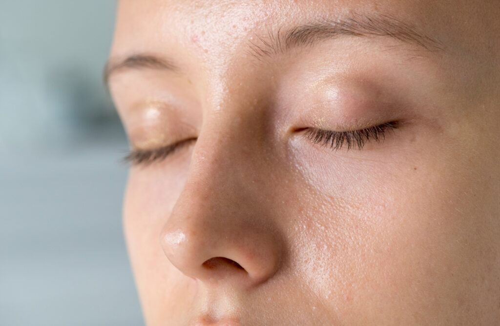 Close-up of a girl's face with visible open pores, showcasing the need for effective open pores treatment.