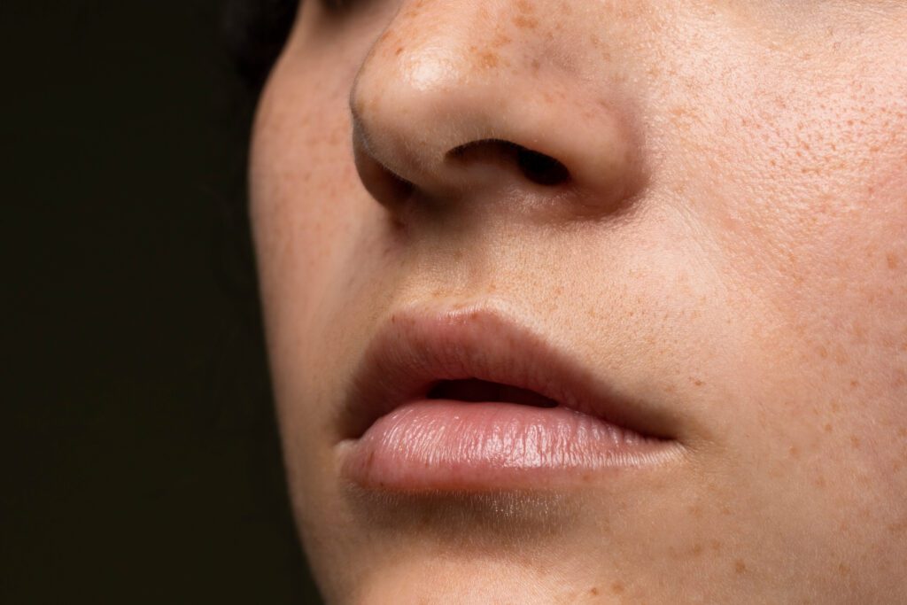 Close-up of tanned skin showing sun damage, highlighting the need for tan removal remedies.